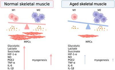 Immunometabolism of macrophages regulates skeletal muscle regeneration